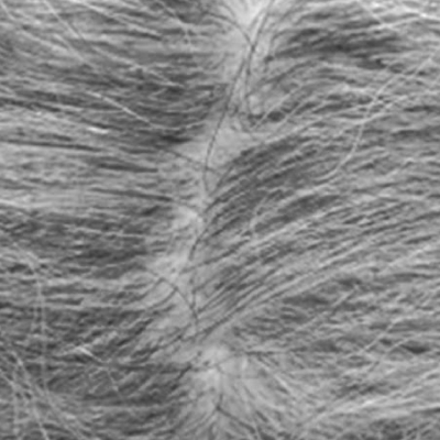 Sensitive scalp care for hair extensions