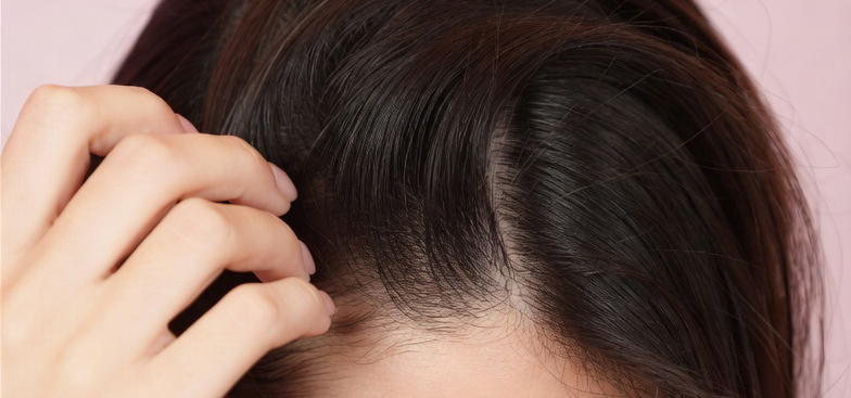 Hair Extensions for Sensitive Scalps: Your Complete Guide to Comfortable Extensions in Australia